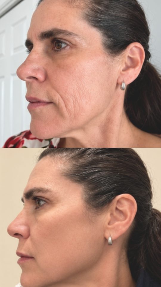 Before and after